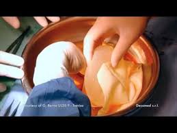 Toni braxton — why won't you love me 04:41. Braxon Surgical Technique Decomed Ufficial Youtube