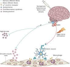 Image result for Adynamic Ileus