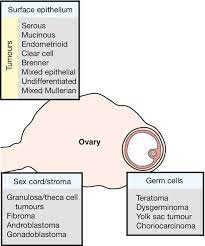 This isn't the case for. Pathology Of Ovarian Tumors Quick Review Epomedicine