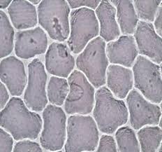 Image result for Oxalis anthelmintica