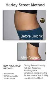 colon hydrotherapy weight loss benefits
