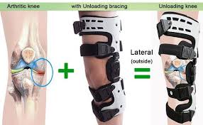 Pin On Knee Brace Fashion