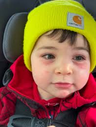 Does anyone know if these are Celiac safe? They say GF, but I have a  reaction everyday. Thanks in advance ☺️