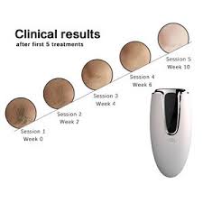 Laser technology vs intense pulsed light. Ipl Machine For Home Use Best Laser Hair Removal Kit Light Face Facial Spa At From China Tradewheel Com