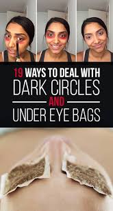 How to cover dark circles and bags under eyes. 19 Ways To Deal With Dark Circles And Under Eye Bags