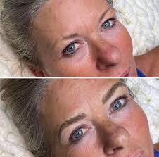 Best place for a hydrafacial please? 🙏🏻