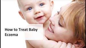 Apply this paste on the eczema to prevent itching sensation. Home Remedies For Baby Eczema Youtube