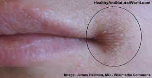 Pin On Health Natural Remedies
