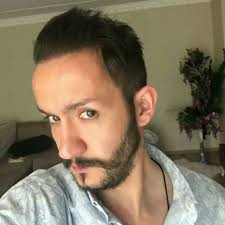 Ardahan Dan Gelen Deniz Bey E 12 Ay Once Sac Ekimi Yaptik Prp Platelet Trabzon Turkey Prptedavisi Sac Hair Hairloss Kellik