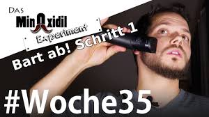 Coins and dollar bills (excluding $50 and $100 bills). Der Bart Kommt Ab Stufe1 Das Minoxidil Experiment Woche35 Youtube