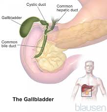 Gallbladder And Biliary Tract Liver And Gallbladder Disorders Merck Manuals Consumer Version Gallbladder Bile Duct Gallbladder Surgery