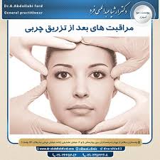 بعد از تزریق ژل صورت چی بخورم + سردرد بعد از عمل بینی تا کی ادامه دارد