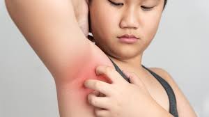 Check spelling or type a new query. What Does It Mean When Your Armpits Are Itchy