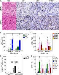 Physicians often first detect mesothelioma late in the course of the disease, usually with a poor prognosis. Characterization Of The Immune Microenvironment In Malignant Pleural Mesothelioma Reveals Prognostic Subgroups Of Patients Lung Cancer