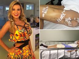 Andressa urach was born on october 11, 1987 in porto alegre, brazil as andressa de faveri urach. Miss Bumbum Runner Up Andressa Urach Almost Died When Plastic Surgery To Plump Her Rear Began To Rot Tissue World News Mirror Online