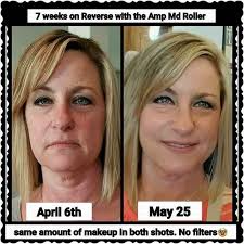 What a difference R+F has made for this happy customer! She says, "I was  very content with my high end department store skincare. But, really hadn't  noticed any significant results. My sister