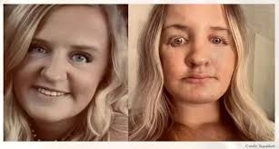 Atlanta plastic surgeon who calls himself "The Eye Guy" is being sued by  several of his patients who say he left them with permanent scarring and  damage: https://2wsb.tv/3zXU3Pf