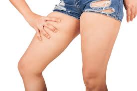 Clothes that irritate your skin can also cause chafing.the friction damages your skin. Chafing Tips For Prevention And Relief