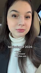 Dear Evan Hansen Costume 2024