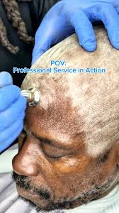 “This brother came all the way from Stone Mountain, Georgia for a true  Gentleman’s Maven experience. When you value your image, you’ll go the  distance. This is more than a bald treatment — it’s ...