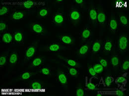 Image result for ANA Staining Pattern