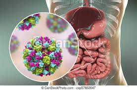 Medical procedure performed to detect, diagnose, or monitor diseases, disease processes, susceptibility, or to determine a course of treatment. Noroviruses Darm Menschliche Abbildung Darm Pain Magen Winter Norovirus Durchfall Rns Familie Virus Agent Canstock