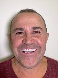 ✨MAIS UM DEPOIMENTO DE NOSSOS PACIENTES!!!✨ Aqui podemos ouvir mais uma  história de uma das nossas pacientes, que realizou o sonho de sorrir  novamente. Agora ela fala com orgulho e sem medo