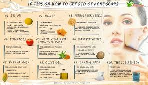 Pin On Beauty Tips