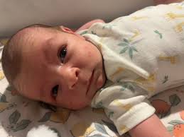 Anyone else develop rash