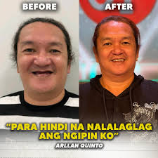 Ang perfect smile? Achieved! 👏🏻 Transformation is real dahil sa tulong ng  Real Herrera Dental Clinic na-achieve nila ang kanilang perfect smile! ❤️