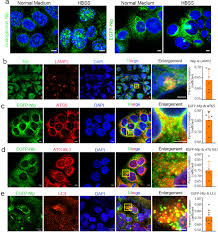 Cells use proteins to perform important functions such as repairing cellular damage and directing chemical processes. Nlp Promotes Autophagy Through Facilitating The Interaction Of Rab7 And Fyco1 Signal Transduction And Targeted Therapy