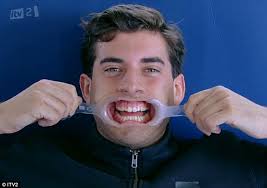 And the thirteenth series of i'm a celebrity.get me out of here!, where he finished in fourth place.in 2015, he won the channel 4 series the jump Veneer Joey Essex Teeth Best Ideas