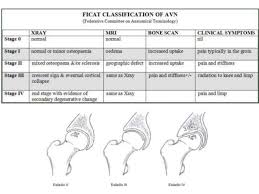 Ficat Classification For Avn Of The Femoral Head Classification Radiology Oedema