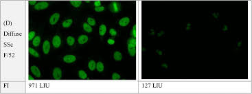 Image result for ANA Staining Pattern