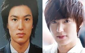 Lee Min Ho Plastic Surgery Rumors Confirmed Plastic Surgery Celebrity Plastic Surgery Lee Min Ho