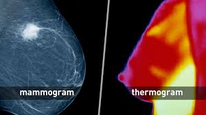 A diagnostic mammogram is monitored by the radiologist at the time of the examination, but starts with the same images as a screening mammogram. Breast Cancer Screening Thermogram No Substitute For Mammogram Fda