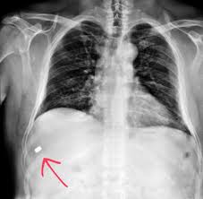 Armed robber fires gun in florida. Pin On X Rays