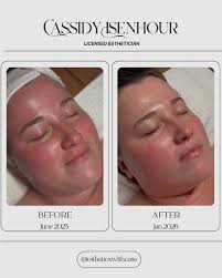 Your treatment is your time to relax, reset, and indulge in the beauty of  self-care 🤍