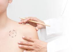 Basal cell carcinoma is a type of skin cancer that begins in the basal cells. Skin Cancer Treatment Dermatology Center Of Loudoun
