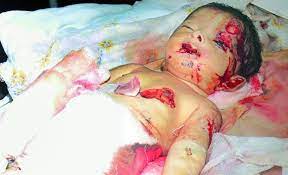 Watch Baby Dies After Rat Bites In Icu Of Guntur Government General Hospital