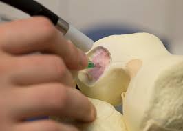 Researchers In Australia Have Developed A Pen To Deposit Regenerative Stem Cells Onto Damaged Bone And Cartilage In A Process Sim 3d Printing 3d Printer Prints