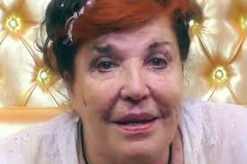 Patrizia de blanck confessioni prima del gf vip: Patrizia De Blanck Avete Visto Le Macchie Sul Suo Viso Ecco Da Cosa Sono State Causate