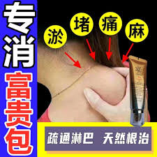 疏通淋巴天然疗法专注消 富贵包颈项后面肿块会影响血液循环甚至毒素堆积久而久之 不止影响美观甚至会影响健康什么是 富贵 包 颈肩部的过度脂肪沉积或者良性的脂肪瘤