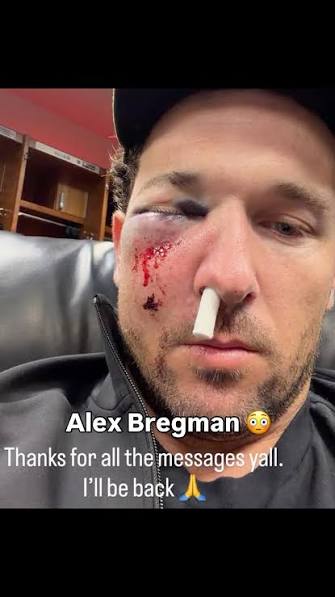Alex Bregman shared an update after getting hit in the face by a foul ball. | ESPN | Facebook