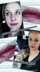 Dog Oral Care Products and Methods