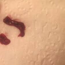 A miscarriage is when a woman loses a pregnancy before the 20th week. Could It Be Miscarriage I Ve Been Bleeding 4 Days Just Regular Blood No Clots No Cramps And Today I Passed This Blood Clot I Am Only 6 Weeks 3 Days My