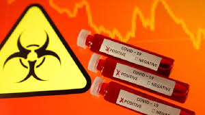 Mereka berdarah a adalah golongan yang pemalu tetapi mementingkan kesempurnaan dalam senyap. Peneliti Golongan Darah A Lebih Mudah Terpapar Virus Corona Gaya Tempo Co