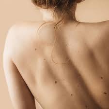 These infections are quite common and often cause an irritating rash. What Do Red Spots On Skin Mean 13 Skin Spots Bumps Pictures
