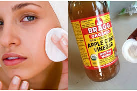 Manfaat cuka apel untuk kesehatan sumber gambar: Dari Toner Hingga Scrub Inilah 5 Cara Menggunakan Cuka Apel Untuk Jerawat