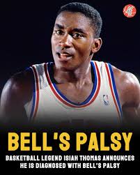 Isiah Thomas' Health Concerns: Possible Bell's Palsy Diagnosis
